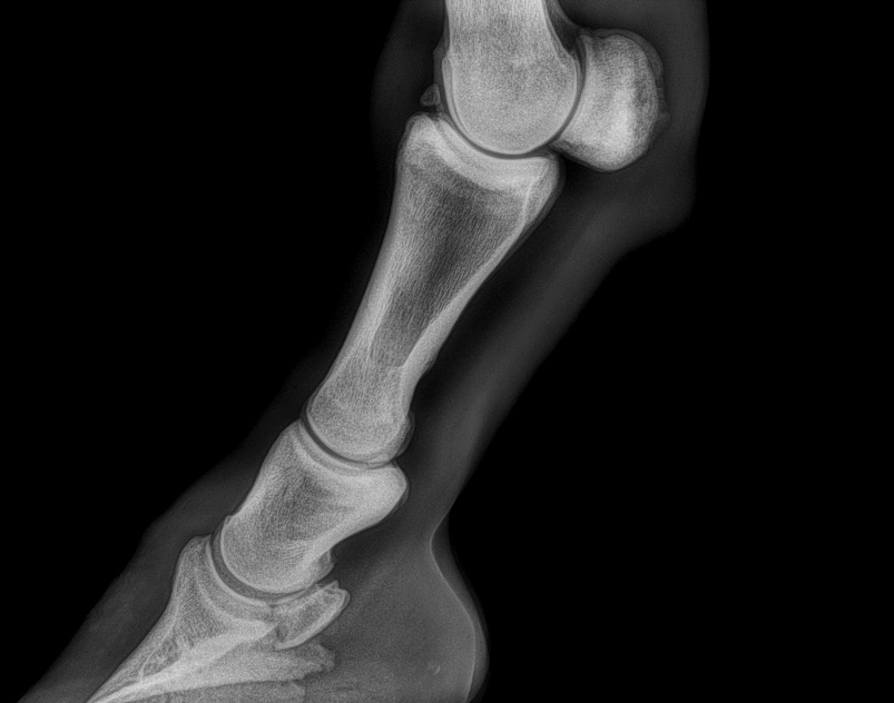 cum se tratează artroza genunchilor artroza articulațiilor simptomelor piciorului